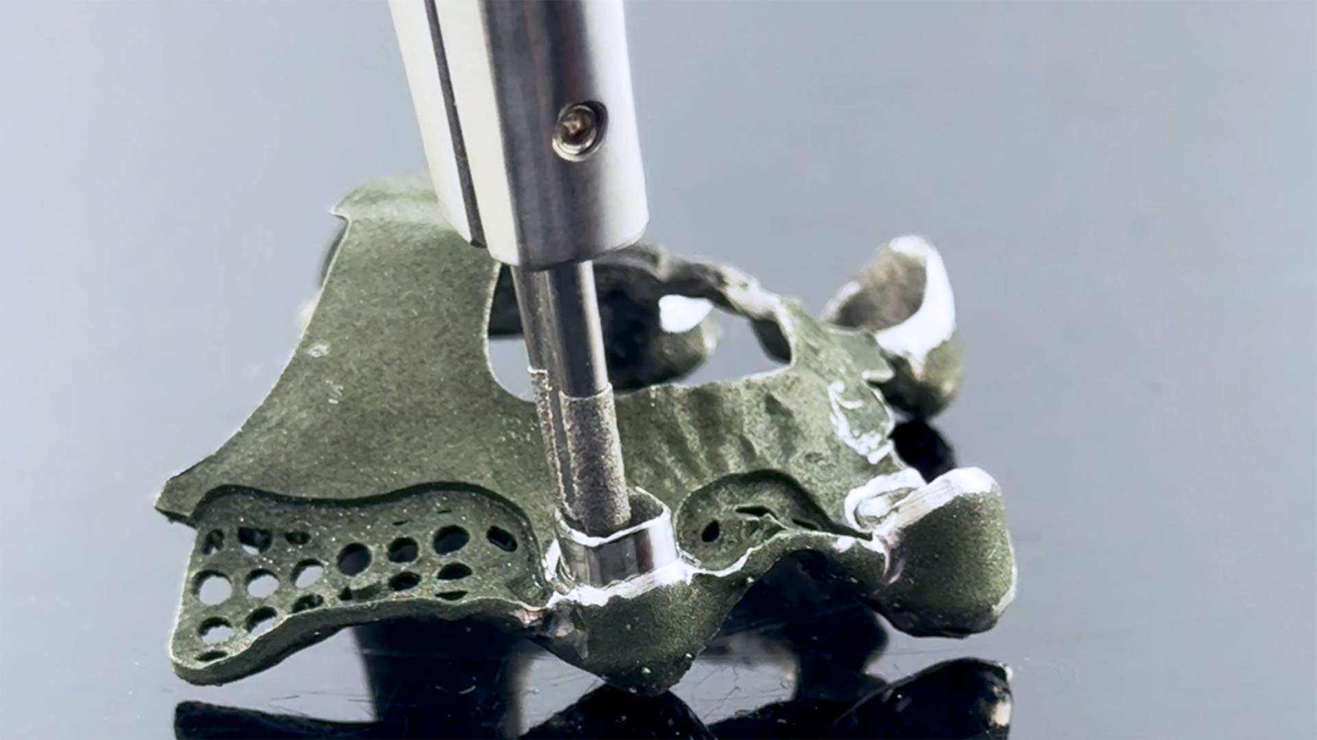 Teleskope 3D-Dental Hamburg