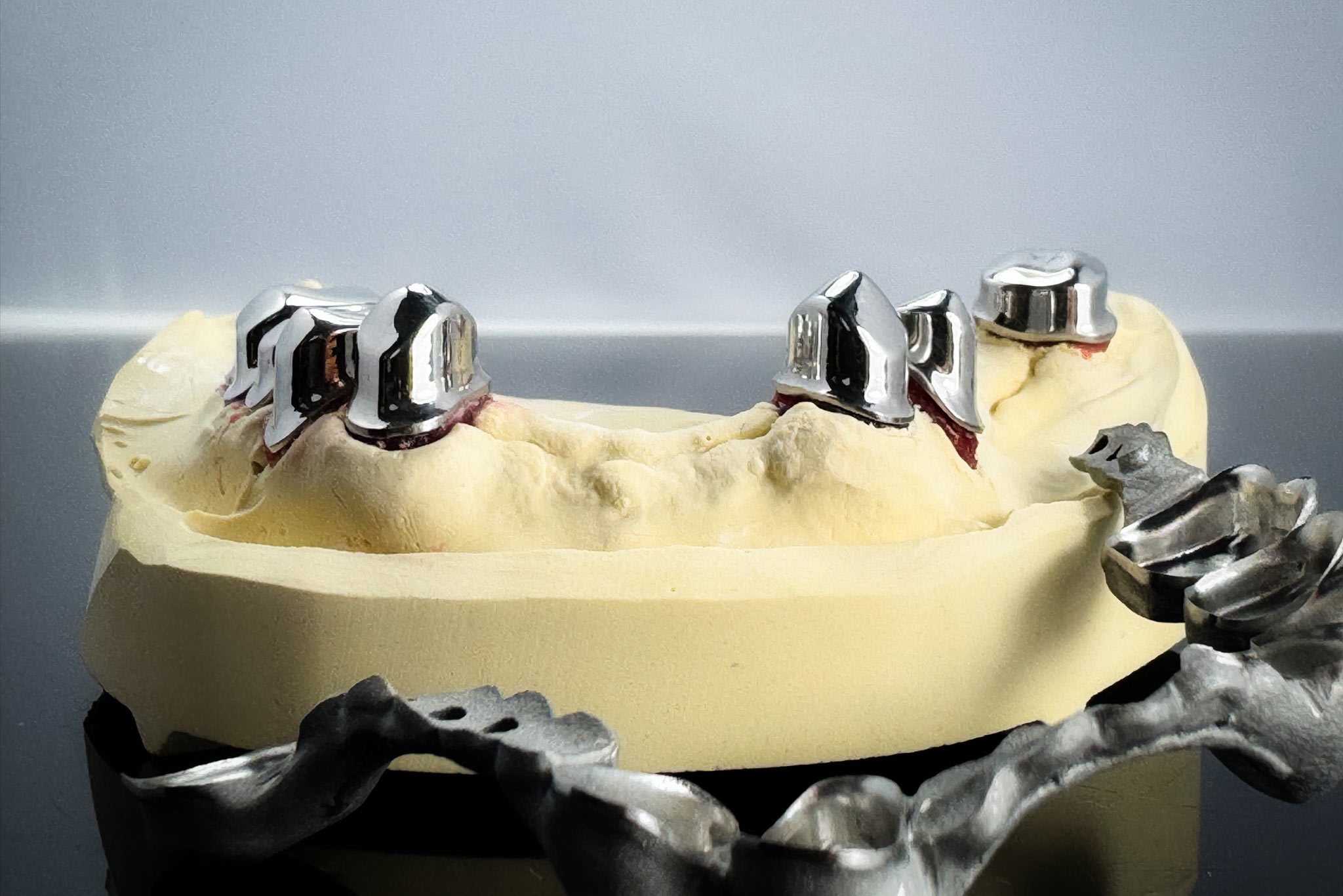 Das geht nur additiv SLM