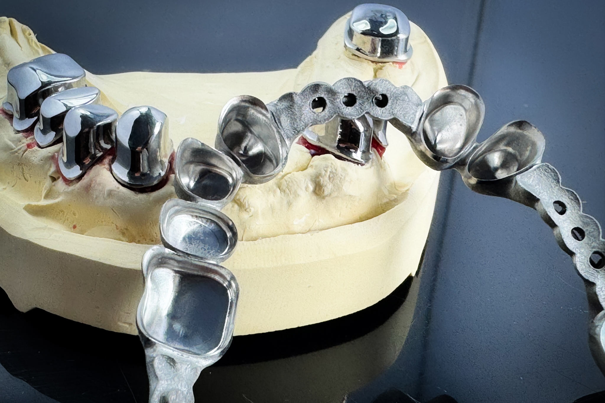 Innenfläche Hochglanz Subtraktiv nachgefräst additiv gedrucktes Metallgerüst