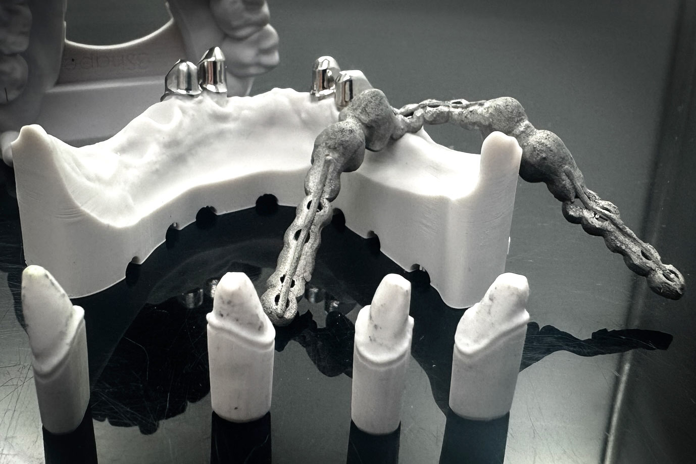Volldigitaler Workflow Hybrid-Verfahren additiv SLM