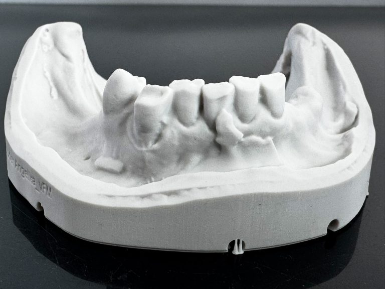 3D-gedrucktes Modell stl-Datensatz Intraoralscanner