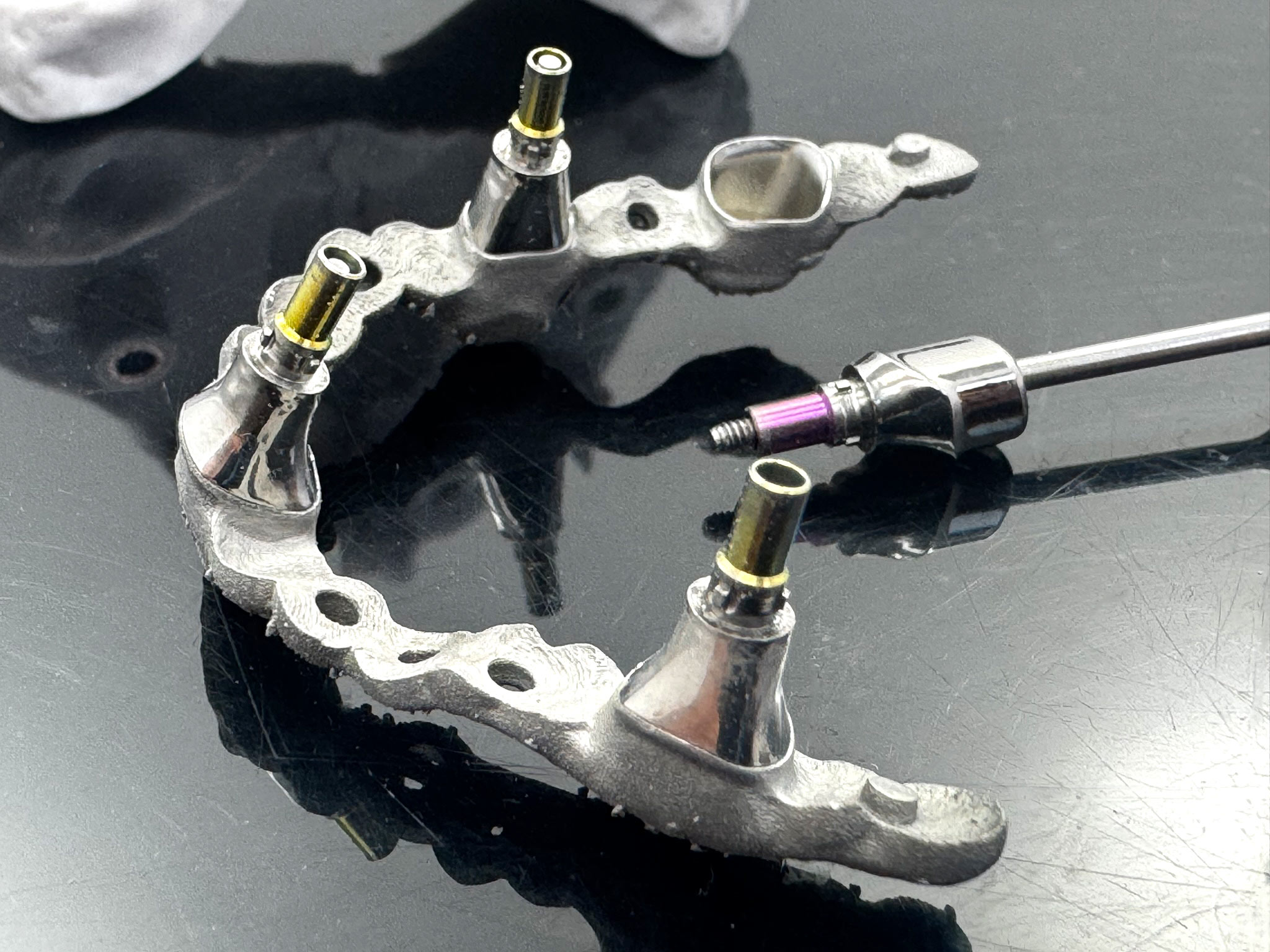 Auftragsarbeit – Implantate-all-on-4 Tertiärgerüst