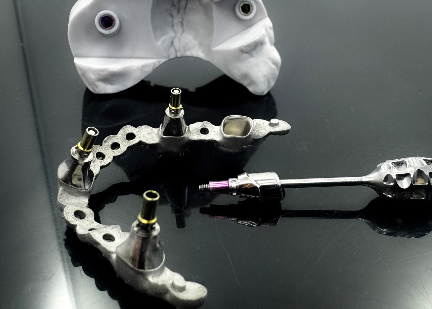 Auftragsarbeit additiv Pulverbettverfahren SLM-gedrucktes Tertiärgerüst auf Implantaten individuell subtraktiv gefrästes Abutment als Primärteil