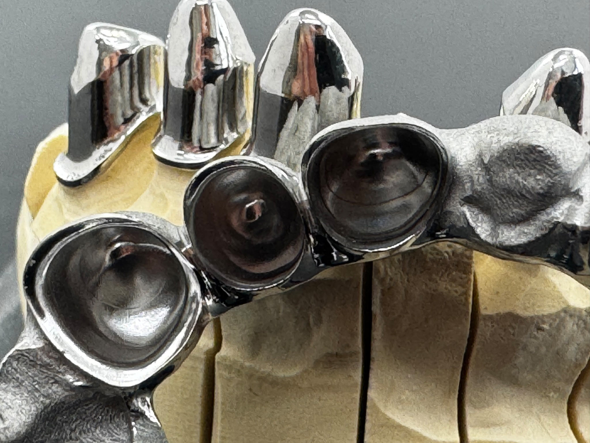 Additiv gedrucktes Tertiär Sekundärgerüst filigran Engstand interdental Hybrid-Workflow Lasermelting