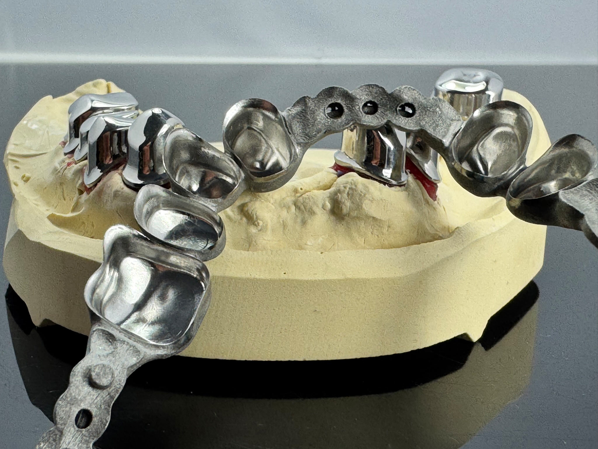 fertig gefräste Primärkronen Metallgerüst Sekundär SLM Lasermelting